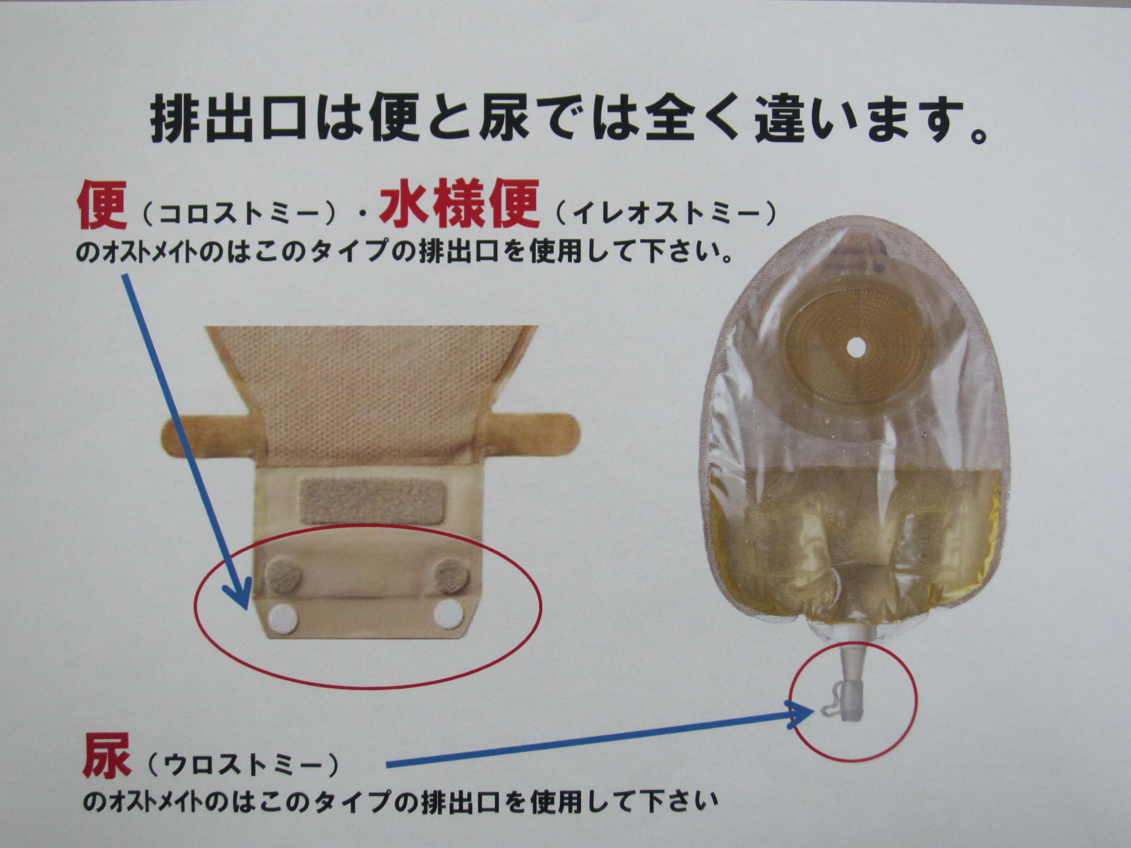 Ostomy Cafe オストミー カフェ 3 製品ｉｎｆｏ